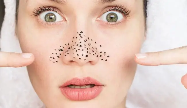 حبوب الانف على ماذا تدل