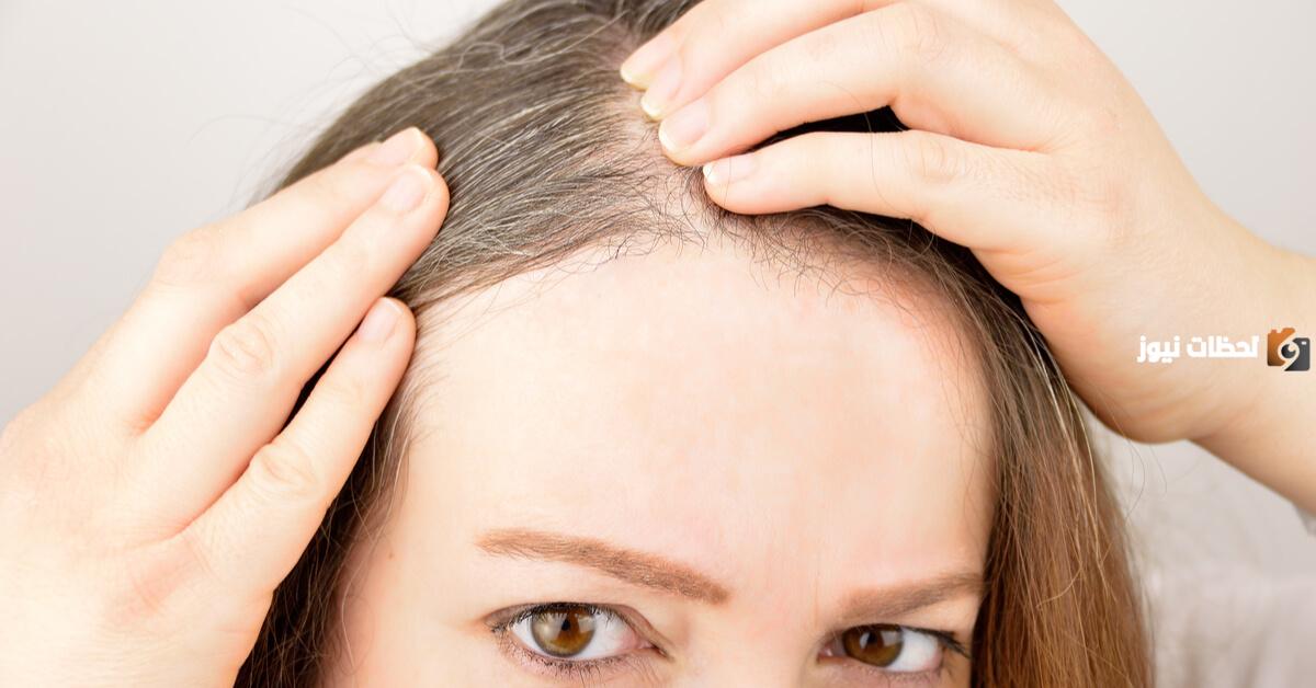 طريقة علاج الشعر الأبيض بالأعشاب