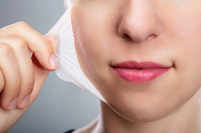 مخاطر إزالة ندوب الوجه بالتقشير