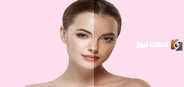 كم مدة التان وكيف يمكن التخلص منه