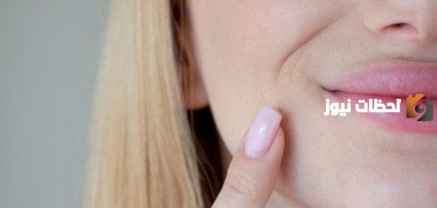 وصفة للسواد حول الفم