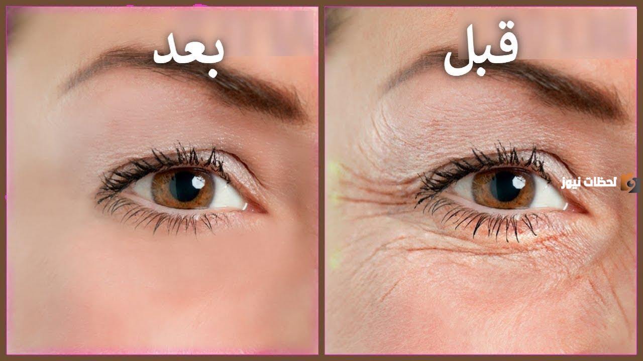 طرق علاج التجاعيد تحت العين مجرب