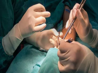 كيف تتم عملية الناسور المستقيمي المهبلي