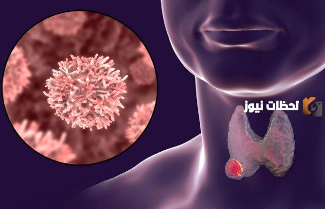 ما هي الأورام اللمفاوية عند الأطفال وأهمية الكشف المبكر عنها