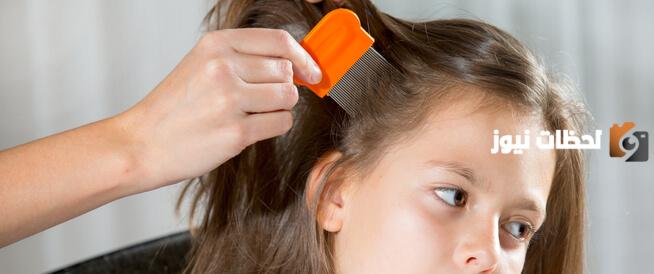 أفضل شامبو للقمل والصيبان