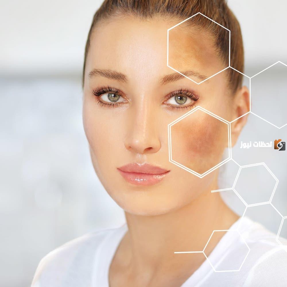 كريم لإزالة البقع السوداء من الوجه