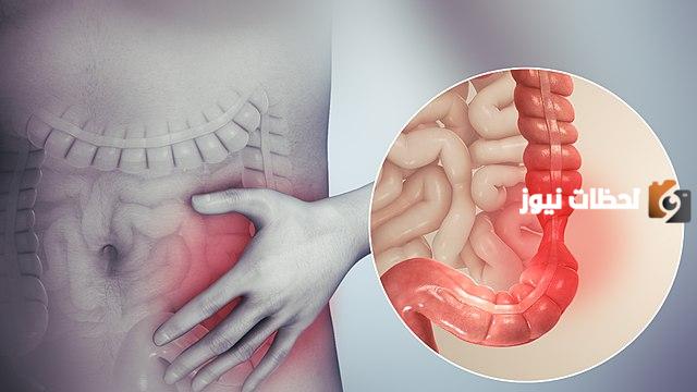 أعراض القولون العصبي عند الرجال