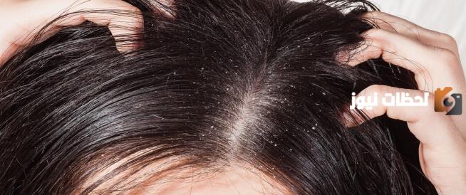 ما هي أسباب ظهور قشرة الرأس