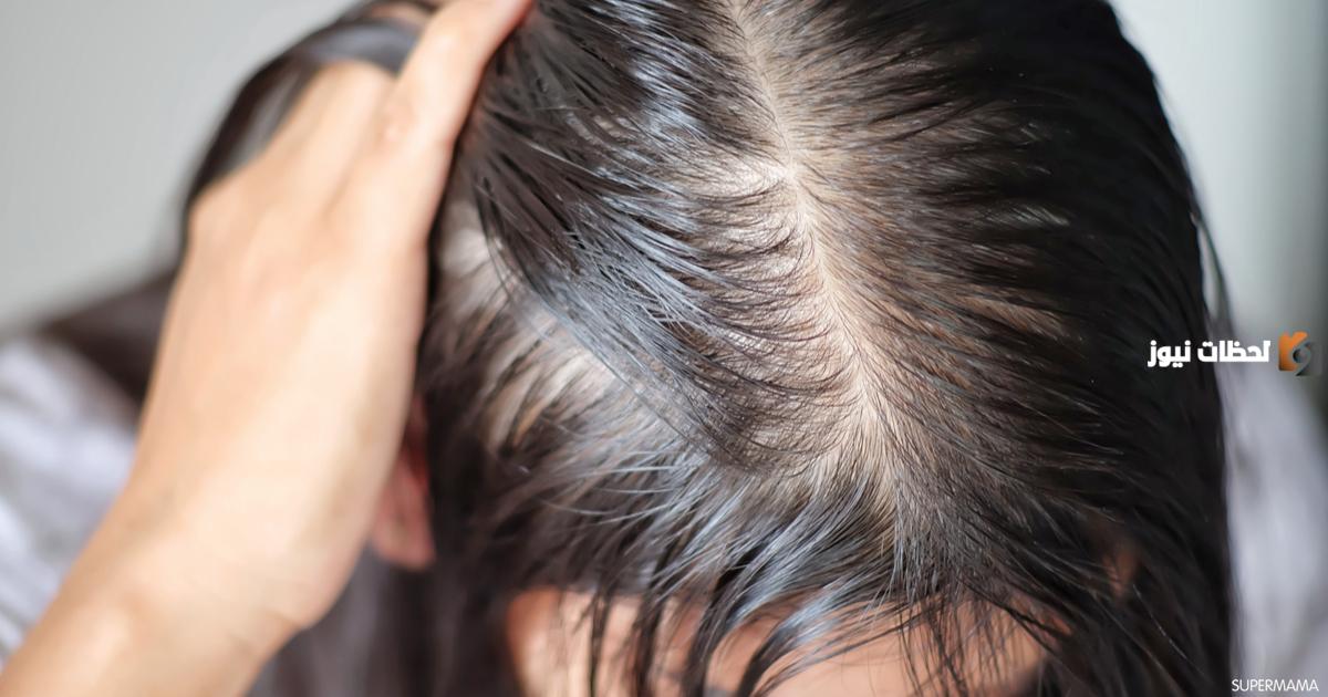 علاج الشعر الخفيف وراثيًا