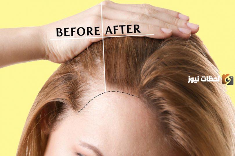 أفضل خلطة لتكثيف الشعر مضمونة