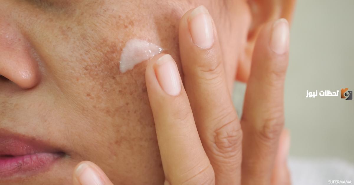 أفضل كريم للكلف من الصيدلية