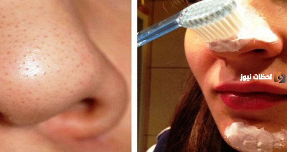 استخدام معجون الأسنان للرؤوس السوداء