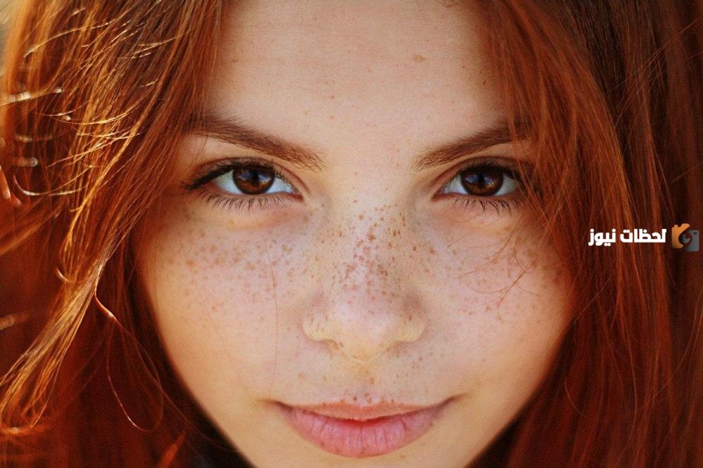 تجربتي مع كريم يزيل النمش من الصيدلية