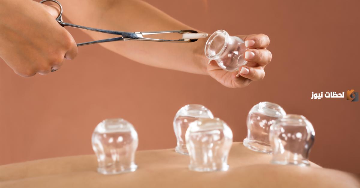 حكم الحجامة في رمضان عند المالكية