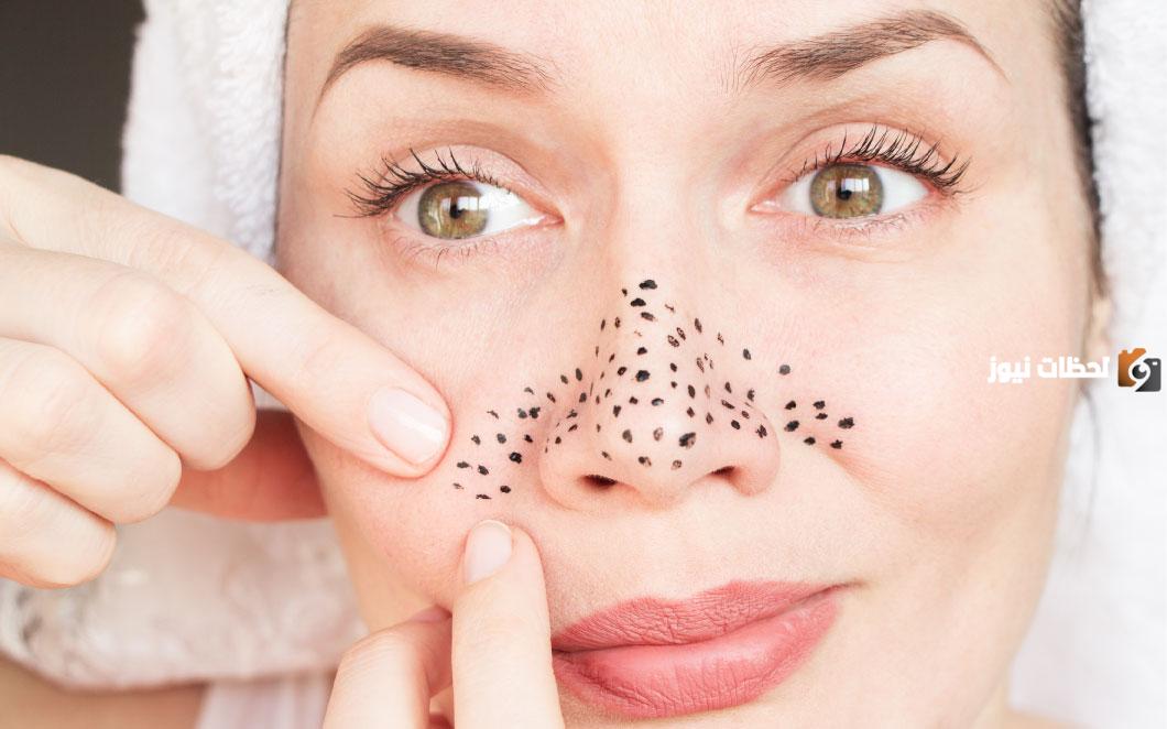 طريقة إزالة الرؤوس السوداء من الأنف