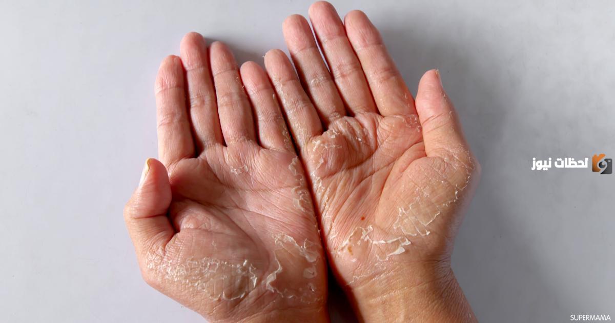 طريقة تقشير جلد اليد