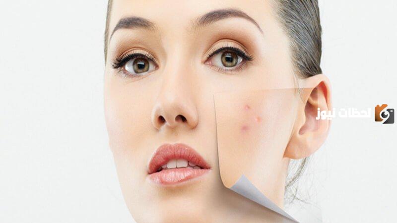 طريقة علاج البقع الداكنة في الوجه