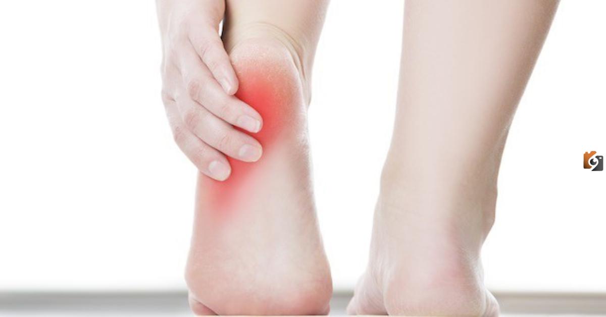 علاج القدم المسطحة Flat feet