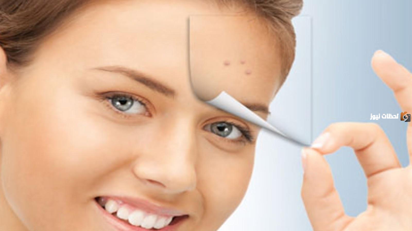 كريم لإزالة البقع السوداء من الوجه