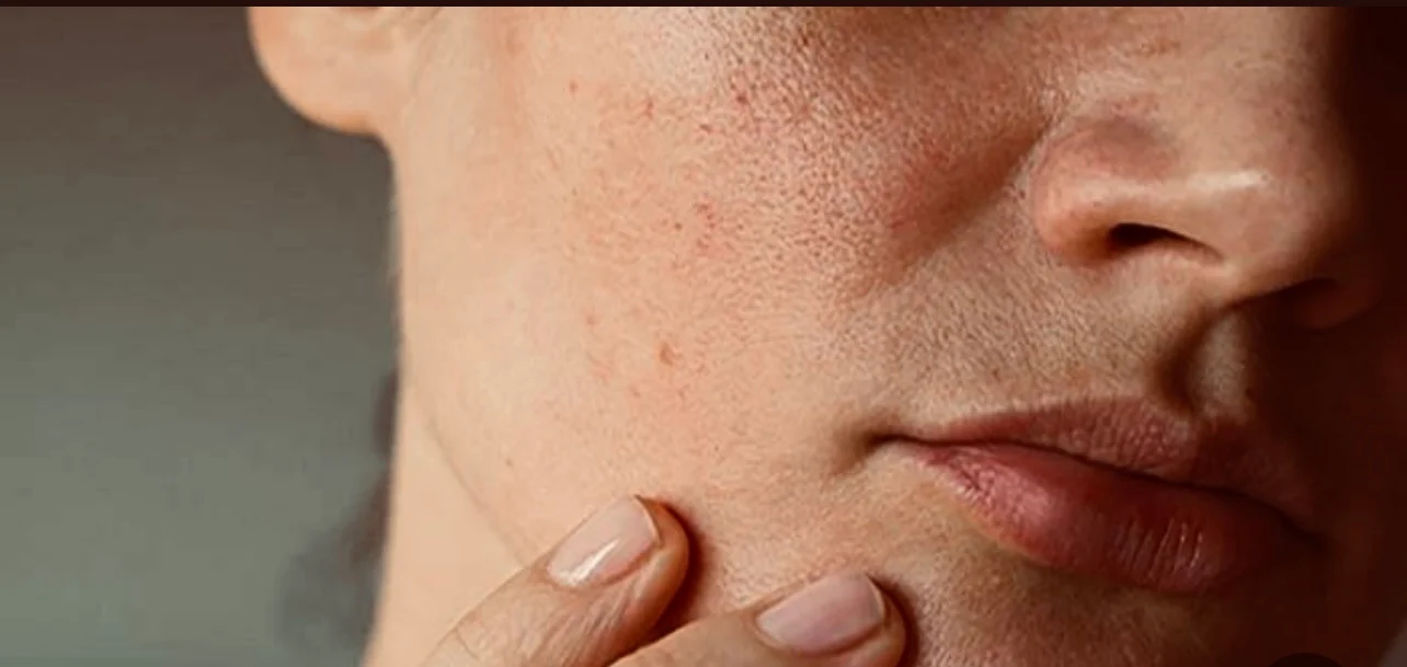 كيف أعالج جفاف الوجه في المنزل