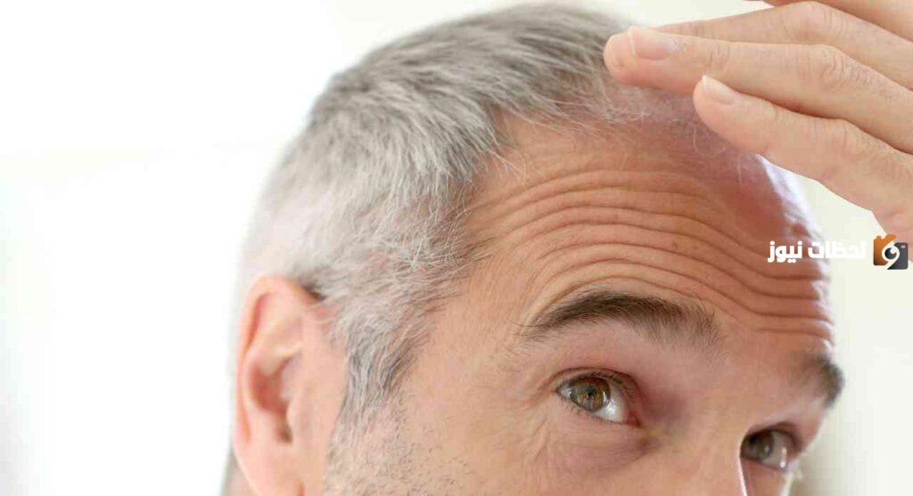 هل يوجد علاج للشعر الأبيض دائم