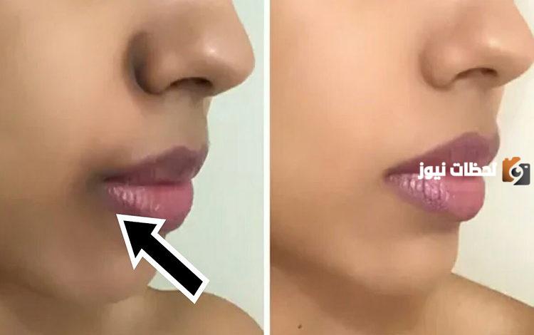 وصفة للسواد حول الفم