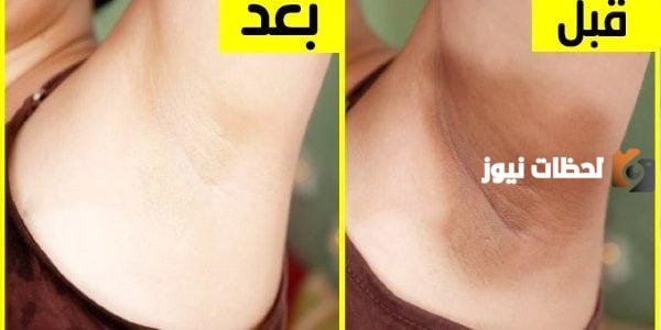 طريقة تفتيح المناطق الحساسة شديدة السواد