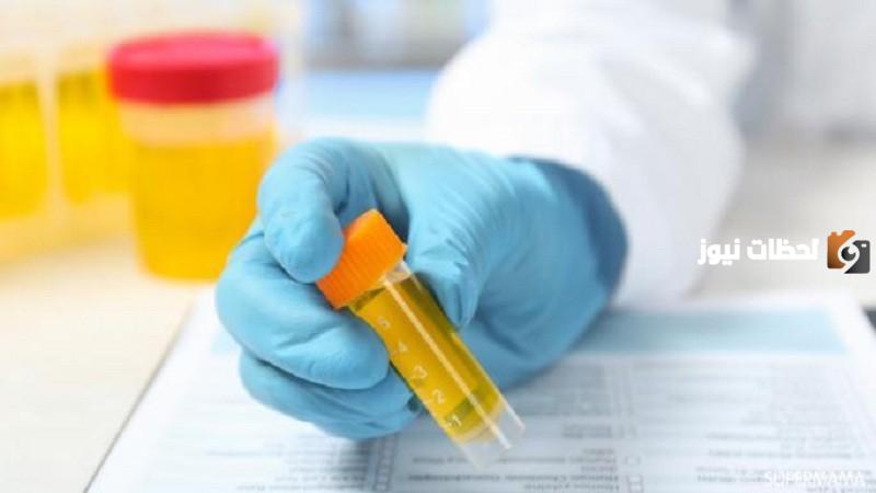 علاج الزلال في البول بالاعشاب في البيت