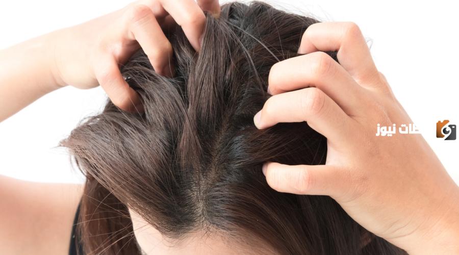 كيف أتخلص من حكة الرأس والقشرة