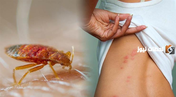 كيف تتخلص من حشرة الفراش نهائيا بوصفات طبيعية ونصائح منزلية