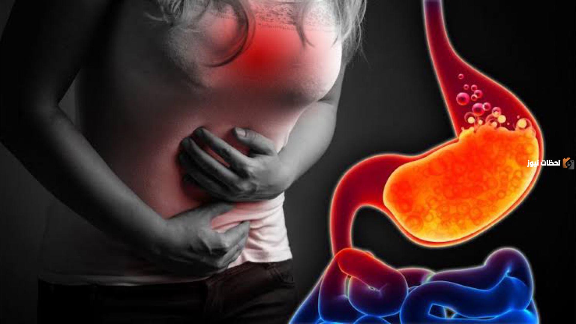 كيف تعالج حموضة المعدة في المنزل