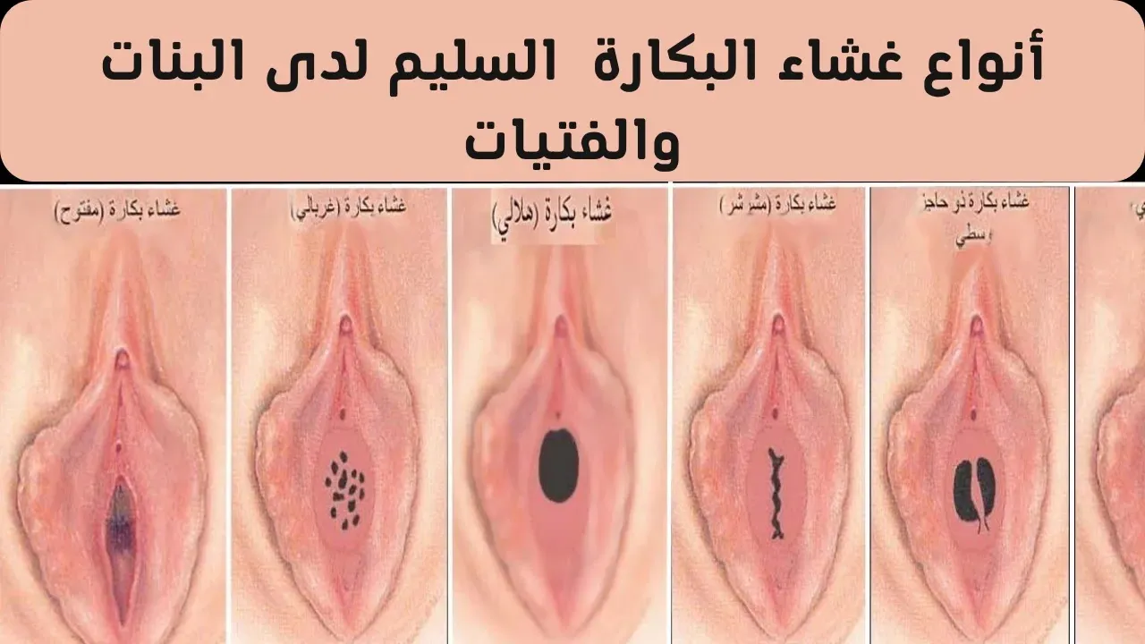 كيف شكل غشاء البكارة السليم