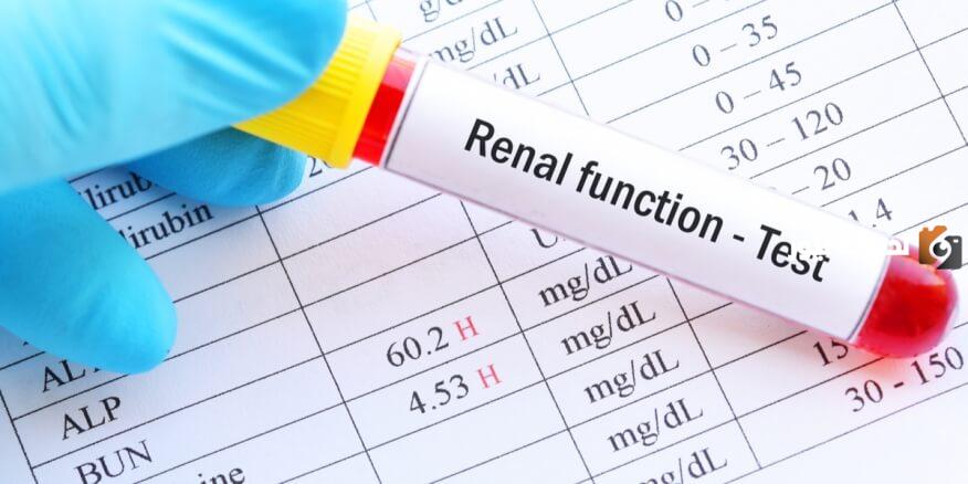 علاج اليوريا المرتفعة