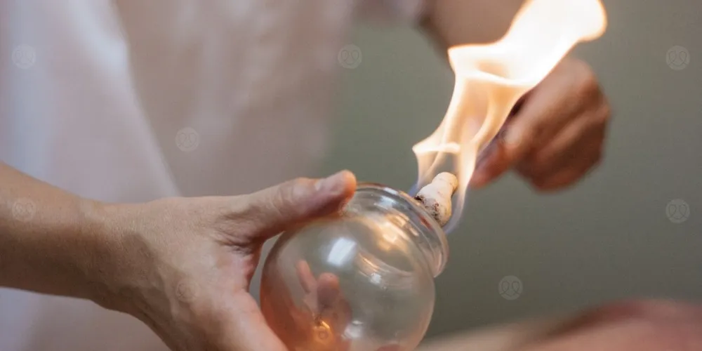 أعراض ما بعد الحجامة وما هو ما يجب القيام به بعد الحجامة