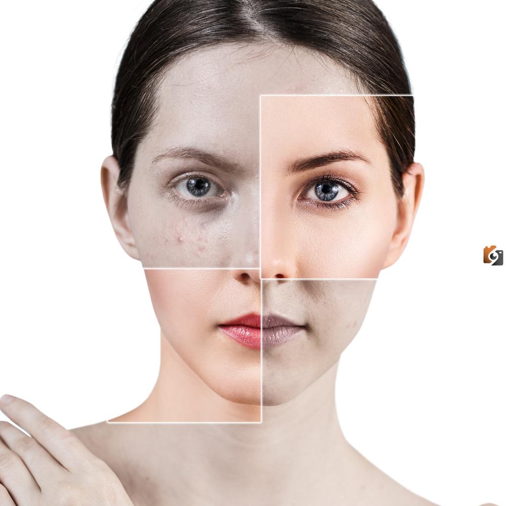 أفضل كريمات تفتيح البشرة الدهنية