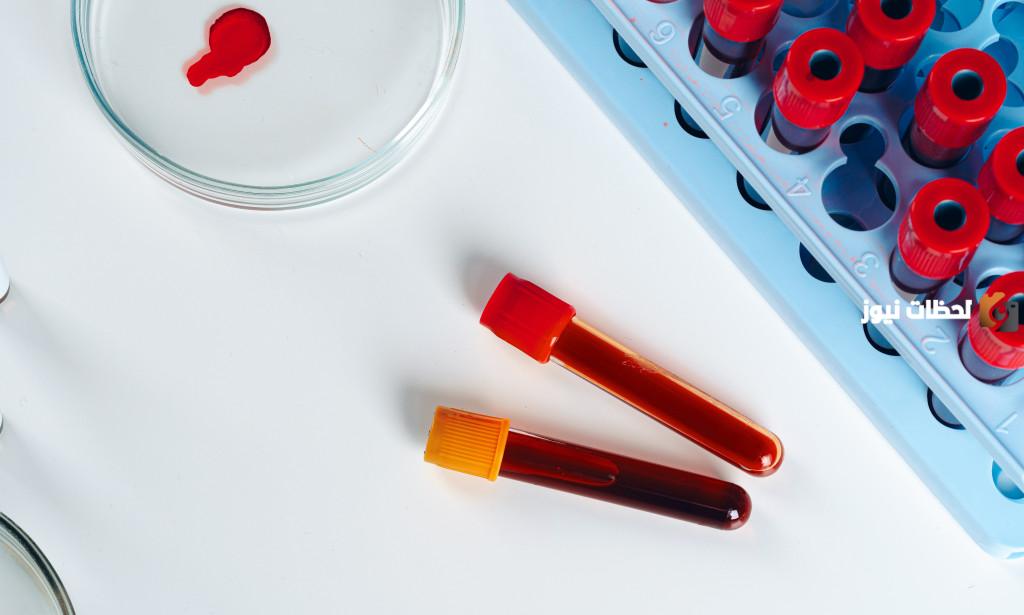 ما معنى ارتفاع تحليل rdw cv