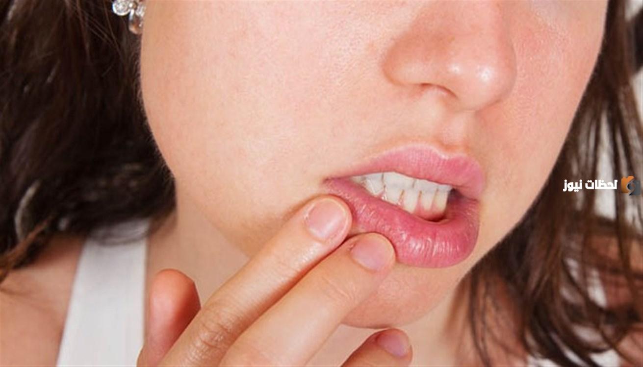 علاج فطريات الفم بالاعشاب والزيوت الطبيعية
