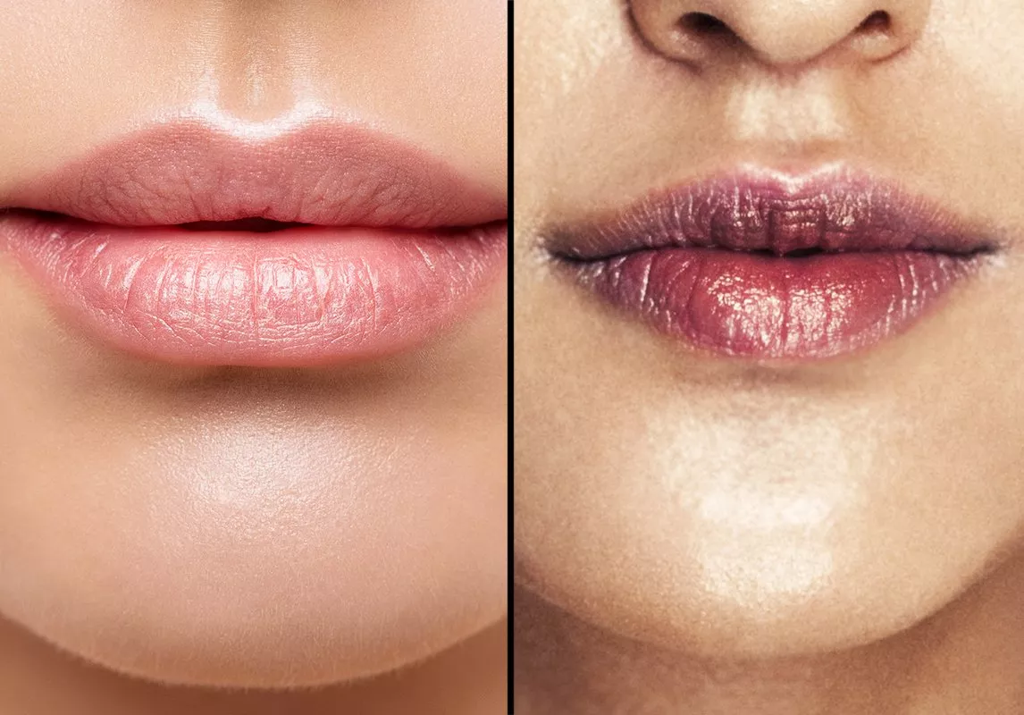 كريم لتفتيح الشفايف من الصيدلية