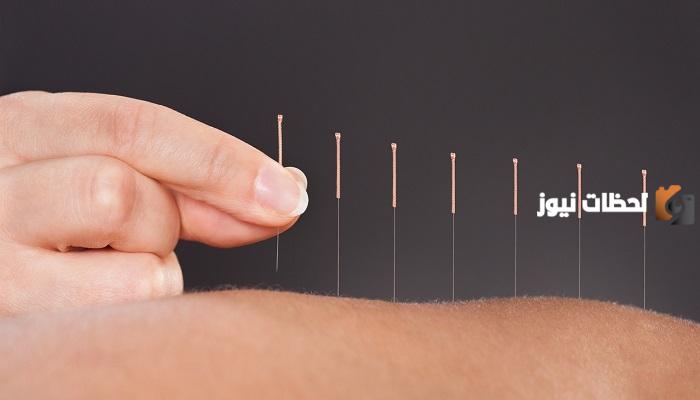 فوائد الإبرة الصينية للتخسيس1