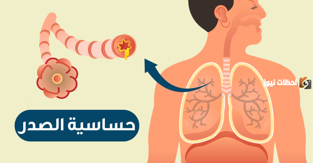 علاج حساسية الصدرية وضيق التنفس