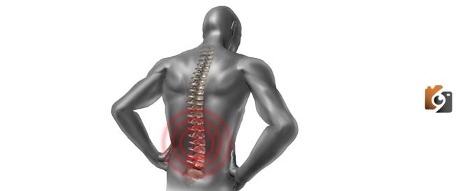 علاج الام الظهر بالاعشاب