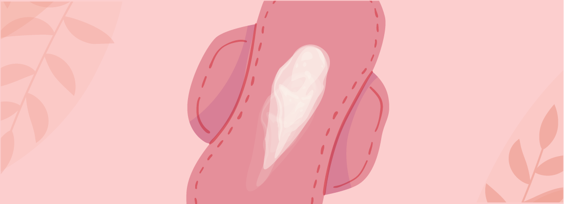 أسباب الإفرازات المهبلية بعد الجماع