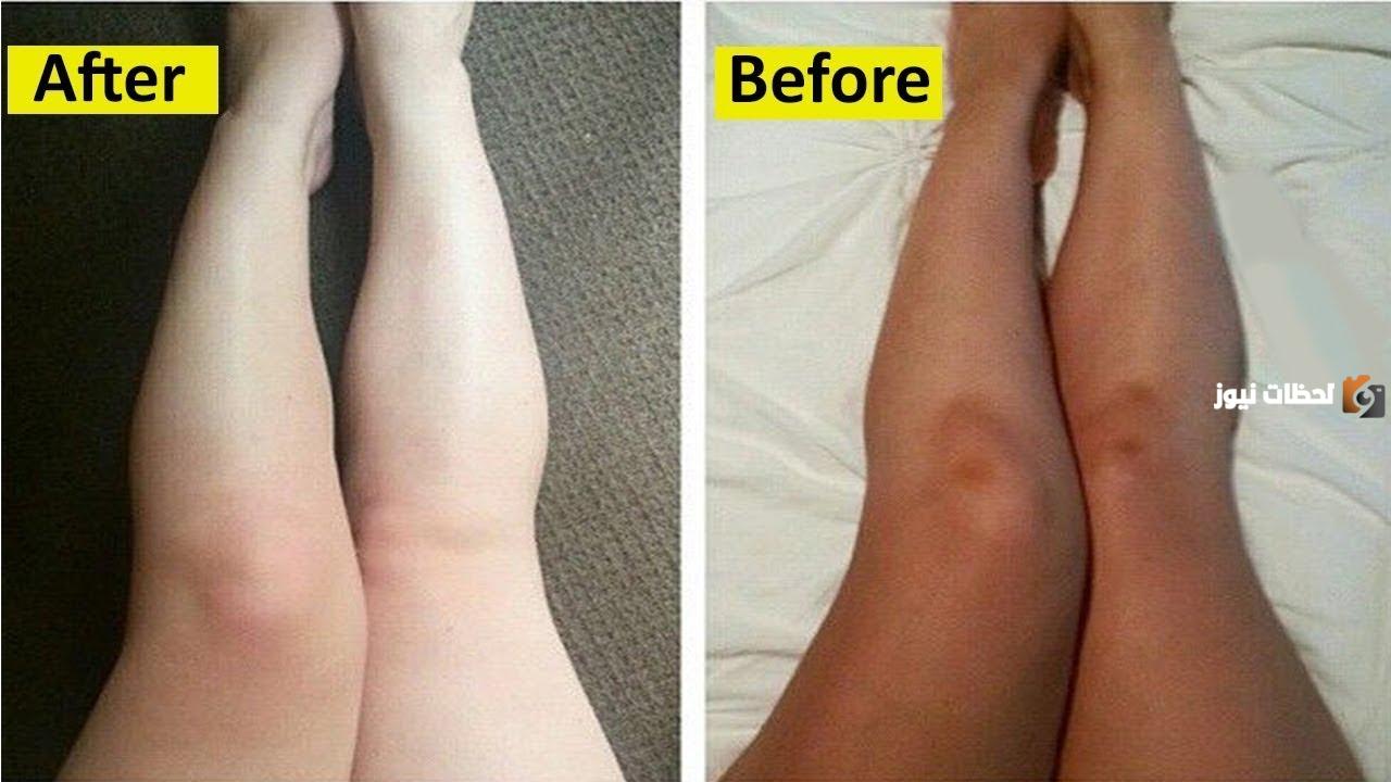 أفضل خلطات تبيض الجسم للعرايس