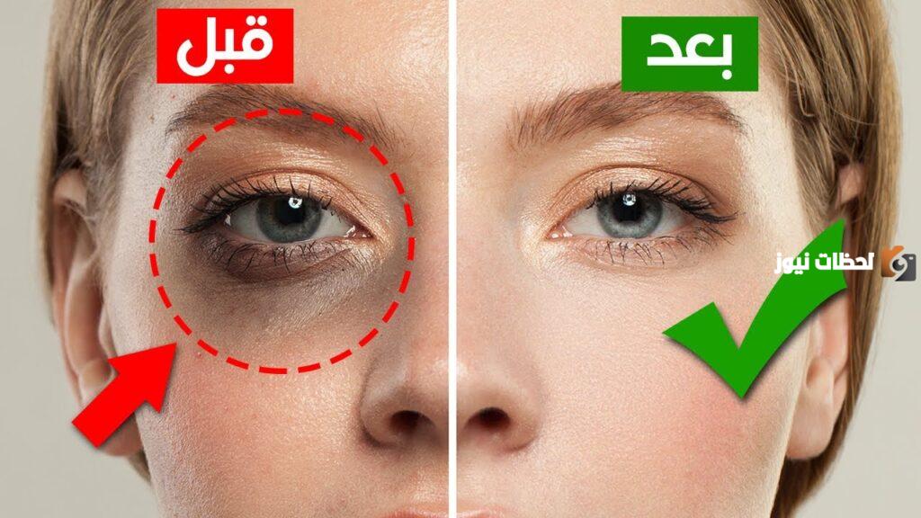 ما هي أفضل طريقة تفتيح حول العين و3 وصفات سهلة