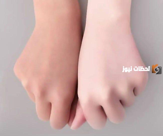 أفضل كريم لتفتيح اليدين