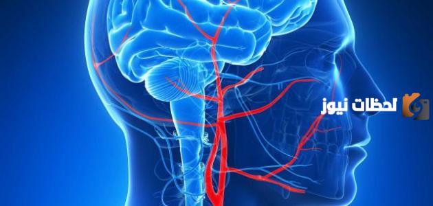 علاج ارتفاع ضغط المخ بالأعشاب