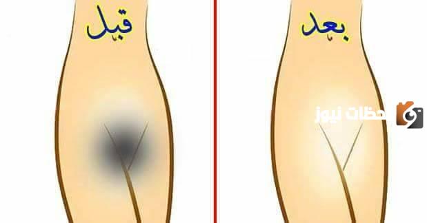 طريقة تبيض المهبل