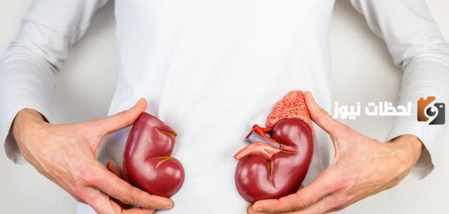 علاج التهاب الكلى بالأعشاب بأسرع طريقة
