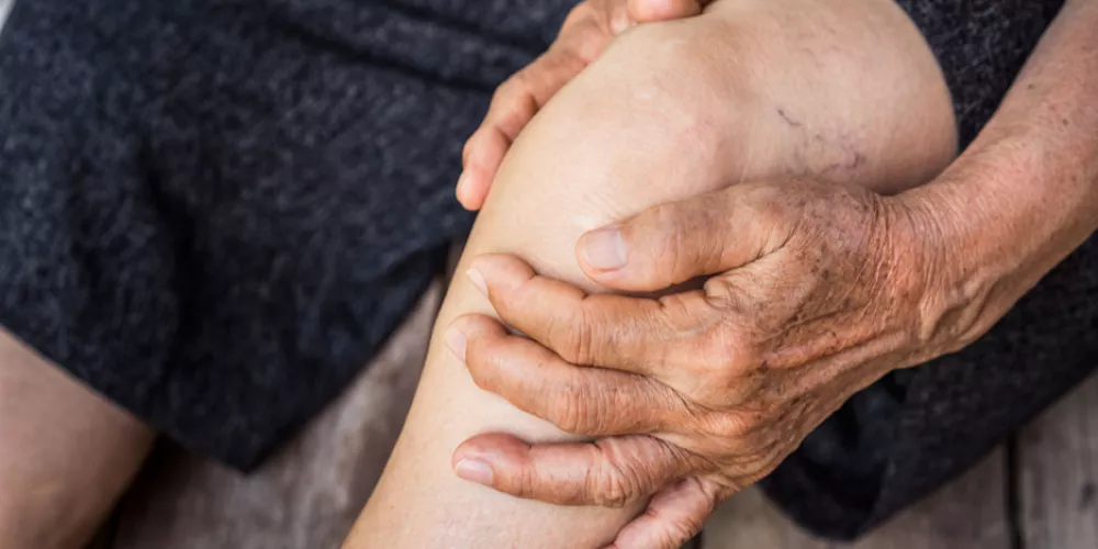 علاج الروماتيزم بالأعشاب من المنزل بوصفات طبيعية