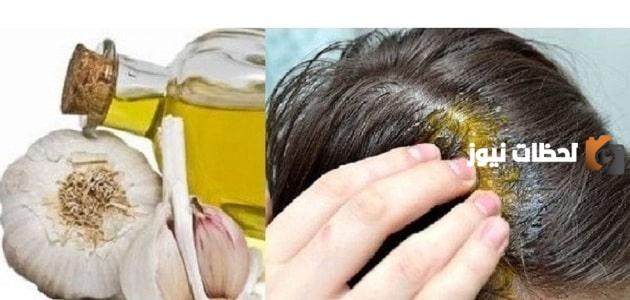 علاج الصلع الوراثي بالبصل والثوم